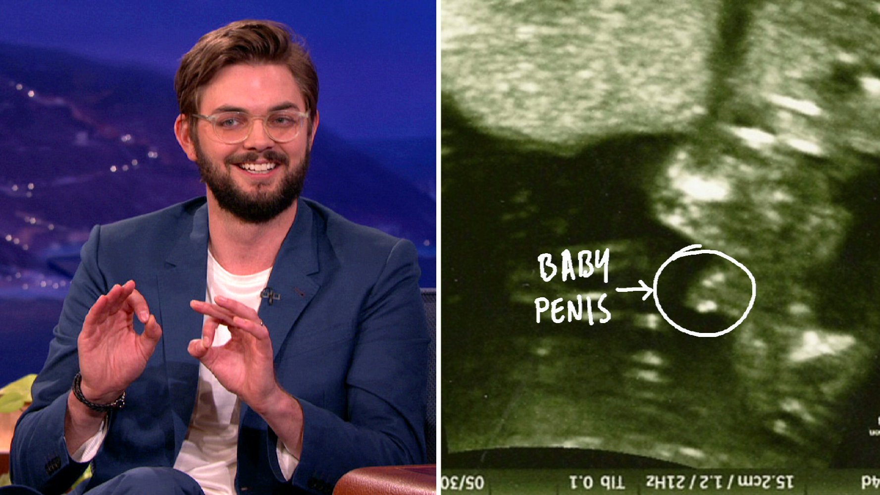 Nick Thune